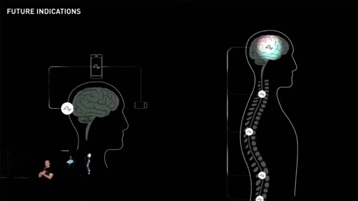 Foto de Elon Musk presentando Neuralink